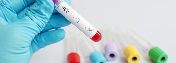 HCV - cichy zabójca! 